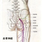 坐骨神経痛改善