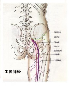 坐骨神経痛改善